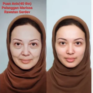 puananis-testimoni