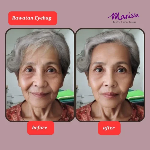 rl-eyebag-ba1-qh1h2z5zhav5o4i9zacgnywrhk156xv1qrl8klxaiw