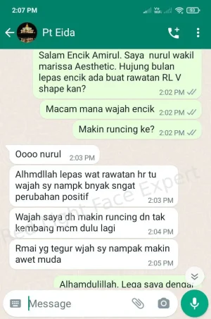rl-vshape-testi2-qh1iquhucp9wv5wn7zmktf00b3exp62hqhaxr791v6