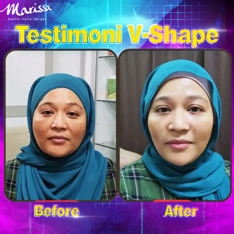 Testimoni-V-shape