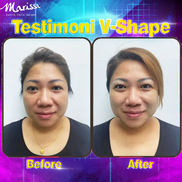 Testimoni-V-shape2