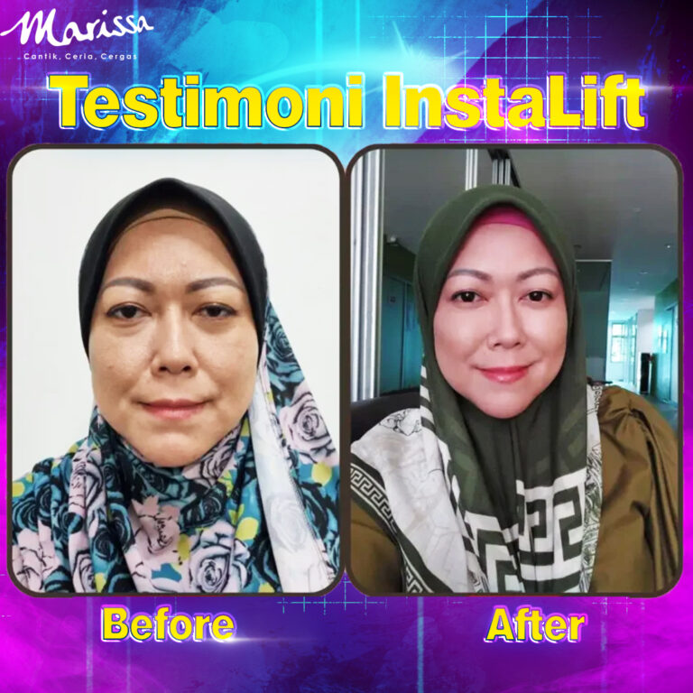 testimoni-instalift
