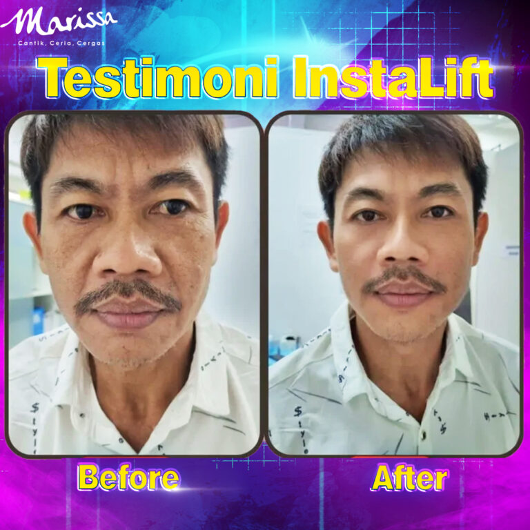 testimoni-instalift2