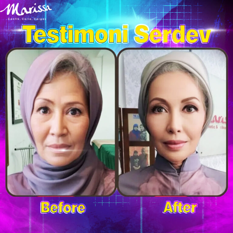 testimoni-serdev