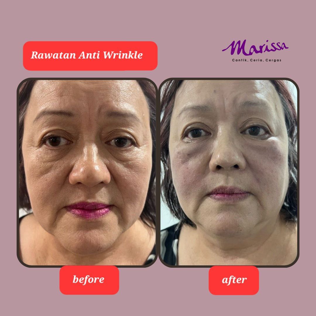 photo-testi-anti-wrinkle.jpg