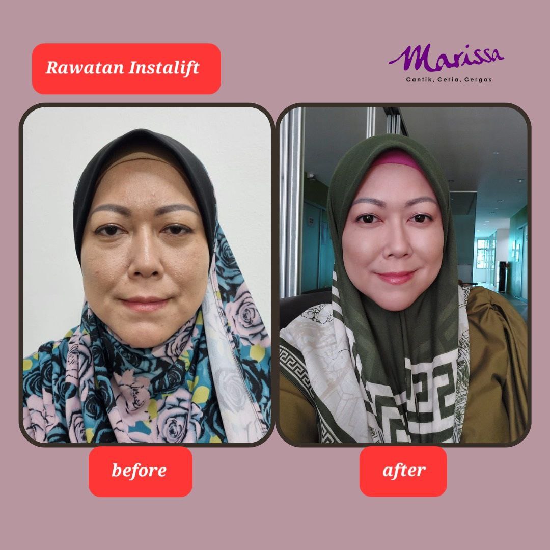 photo-testi-instalift.jpg