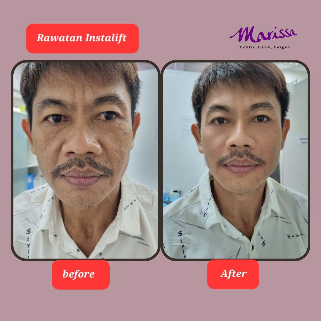 photo-testi-instalift2.jpg